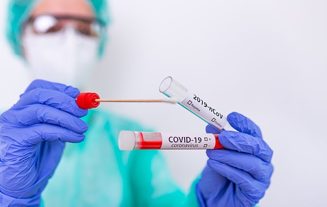 Анализы на COVID-19 (ПЦР и антитела)